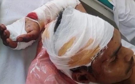 ରେଢ଼ାପଦର ଗାଁରେ ଭାଲୁ ଆକ୍ରମଣରେ ଯୁବକ ଗୁରୁତର,